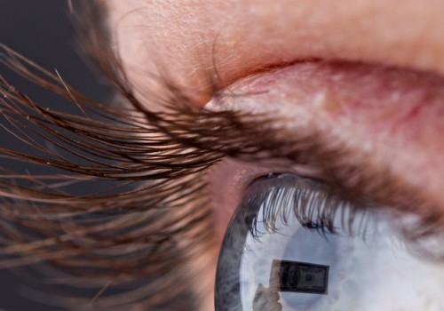 What happens if your eyelashes are too long?